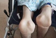 风暴眼丨骗保风波之后:一场“亡羊补牢”的困局-程序员中文网